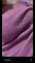 Hanım Akdağ Bigo ifşa videoları part 7 Ön İzleme